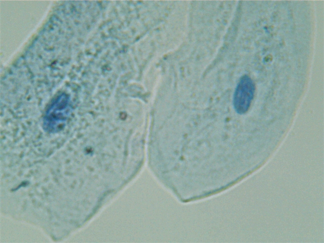 Cheek Cells, Methylene Blue Stain
